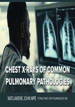 Chest xrays made easy cover